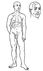 meridian_leber