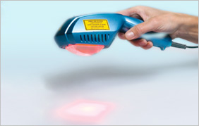 polylaser_derma_on_hand